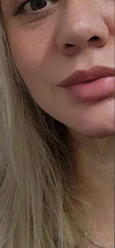 Cherry🍒