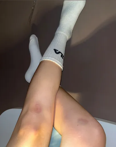 Anais