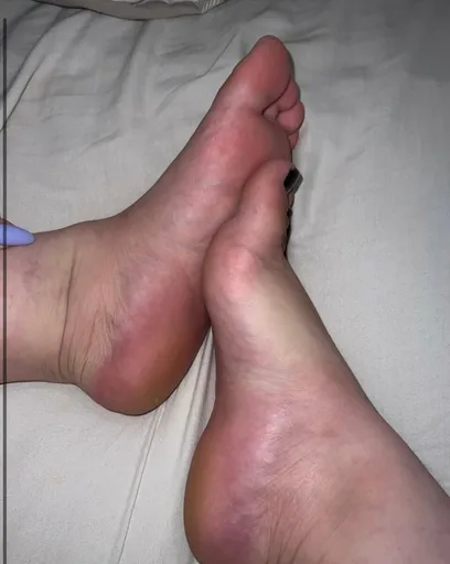 Feet me