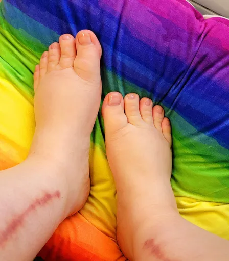 Melody's Feet