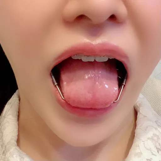 のん🍓