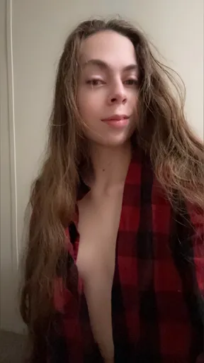 Skye 😘