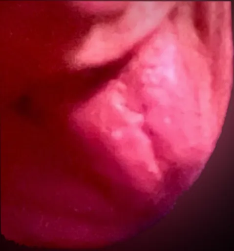 Tin Tongue👅Man