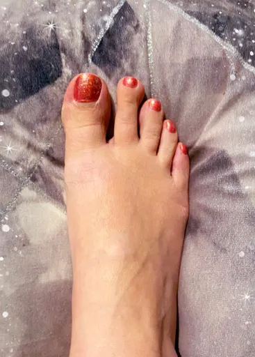 Toe-Racey
