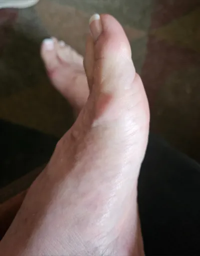 Plump_Toes