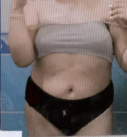 XymaBliss